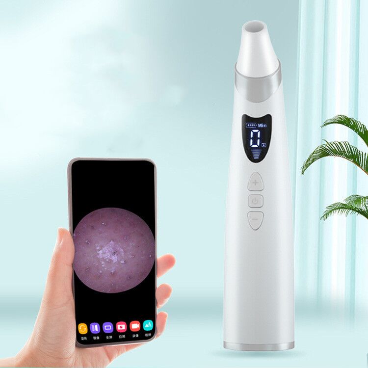 Electric Visual Blackhead Suction Instrument Household Cleansing Pore - Image 1